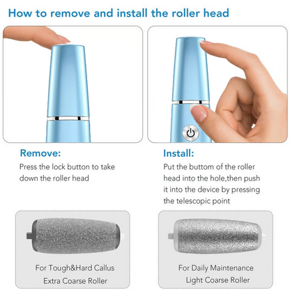 Electric Feet Callus Remover⚡