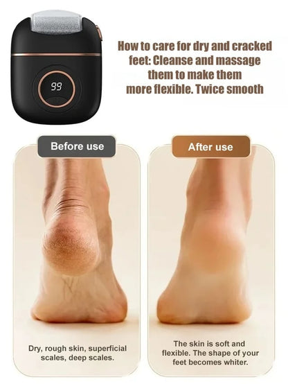 2024 New ArrivalNew Digital Electric Foot Polisher
