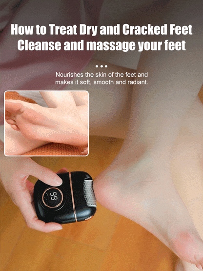 2024 New ArrivalNew Digital Electric Foot Polisher