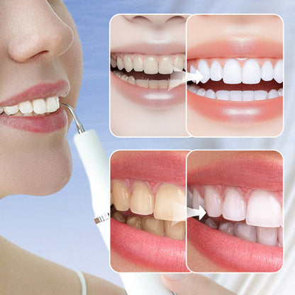 New Year Ultrasonic Flosser for Whitening & Tartar Removal