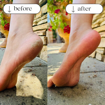 LAST DAY SALE - Foot File