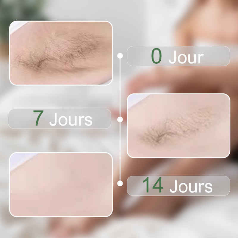 250g Gentle Hair Removal Cream for Men and Women