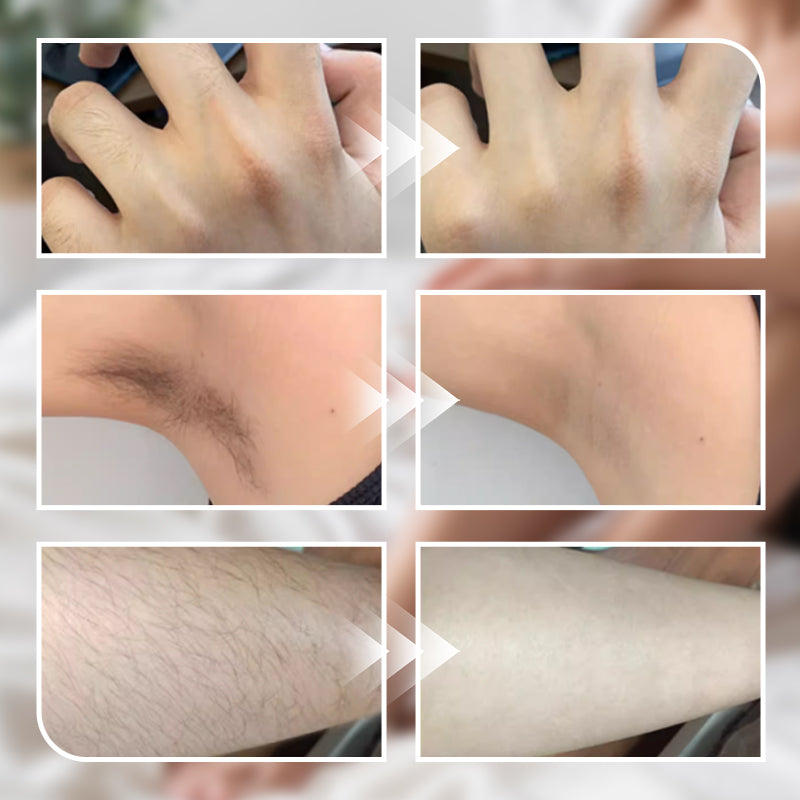 250g Gentle Hair Removal Cream for Men and Women